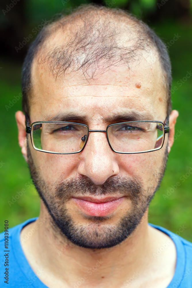 portrait of young man with bad eyesight and hair loss. portrait of young man with bad eyesight and hair loss.