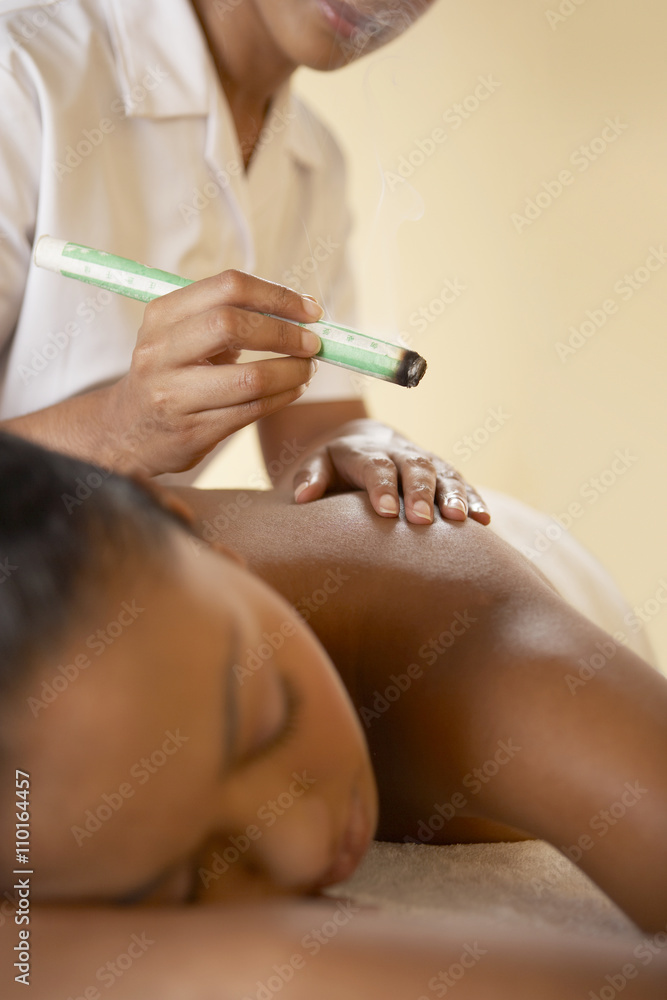 Moxibustion Moxibustion