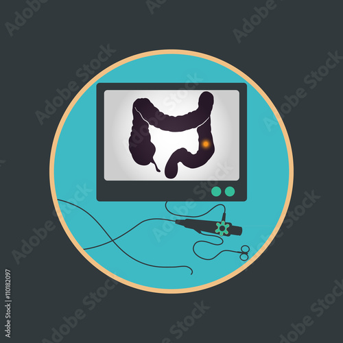 Colonoscopy procedure used for screening colon diseases