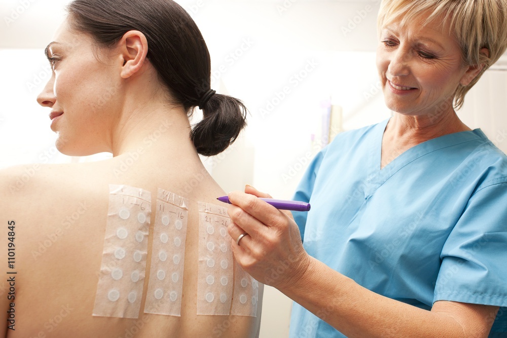 Allergy Patch Test Stock Foto Adobe Stock allergy-patch-test-stock-foto-adobe-stock