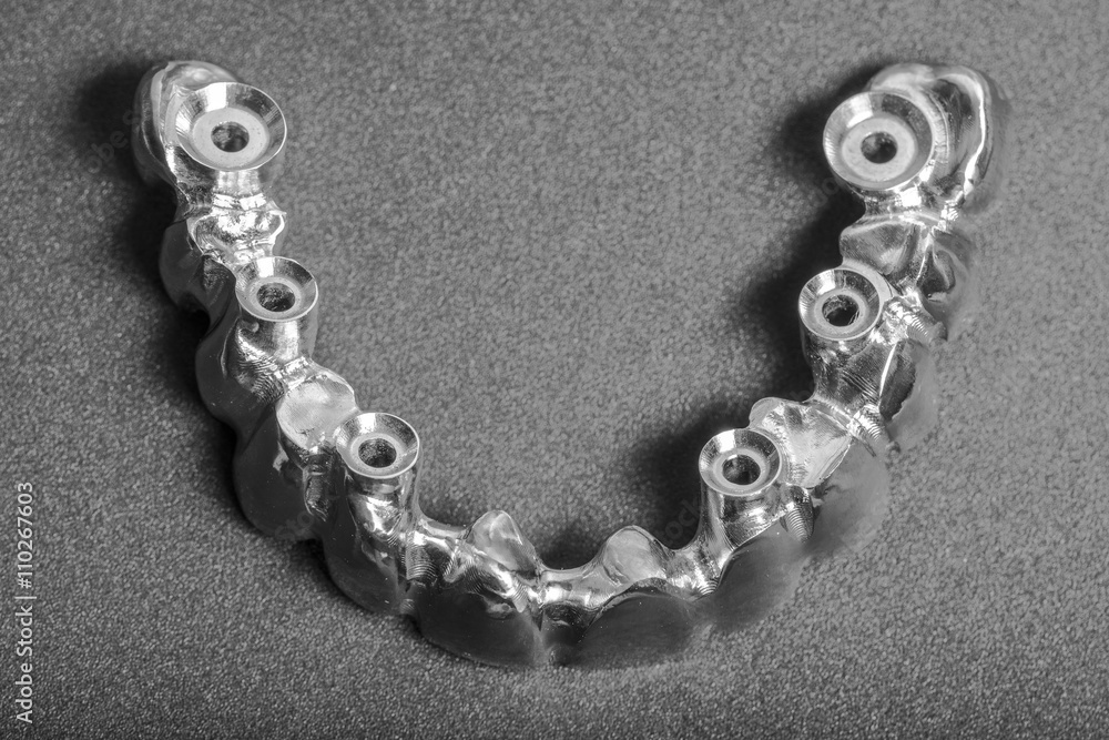 dental prosthetics for dental implants dental prosthetics for dental implants