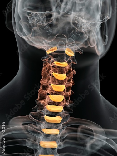 Human intervertebral discs of neck photo