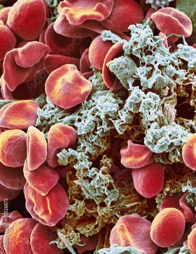 Red blood cells and platelets, SEM photo