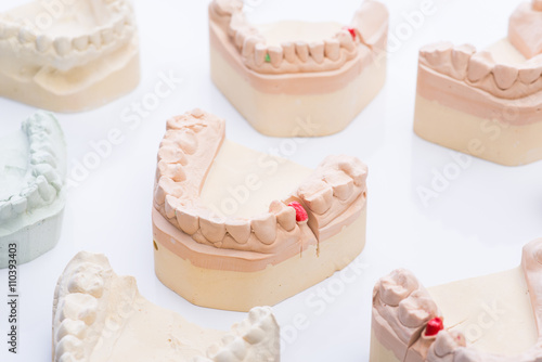 Teeth molds on a bright white table