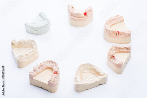Teeth molds on a bright white table