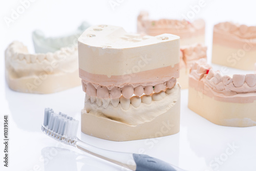 Teeth molds with toothbrush on a bright white table photo