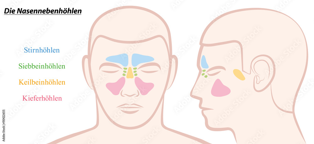 Obraz premium Paranasal sinuses on a male face in different colors - GERMAN TEXT! Isolated vector illustration over white.