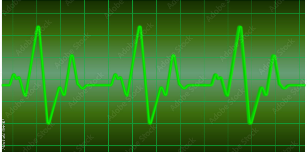 Starke Herzfrequenz grün Sinus Linie durchgehend
