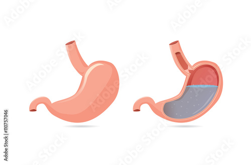 Illustration of outside of stomach muscular and inside which can saw gastric acid.