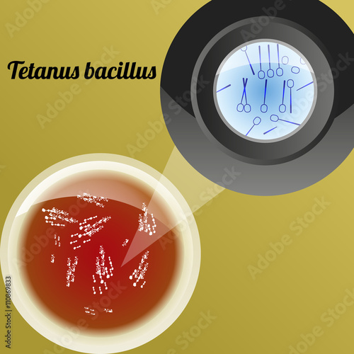 Teranus bacillus