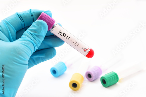 H5N1 influenza virus positive photo