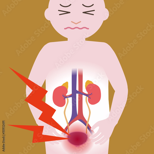 Inflammation of the bladder, human urinary organs, heart, kidney, bladder, vector illustration