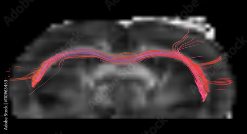 The corpus callosum of a rat brain, in axial plane