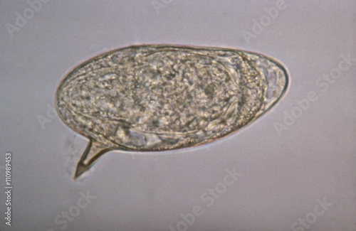 Schistosoma mansoni egg showing lateral spine. Schistosomiasis (also known as bilharzia, snail fever, and Katayama fever) is a disease caused by parasitic worms of the Schistosoma type