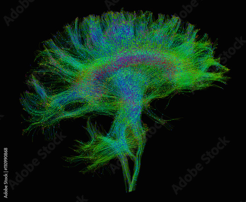 Diffusion MRI, also referred to as diffusion tensor imaging or DTI, of the human brain photo