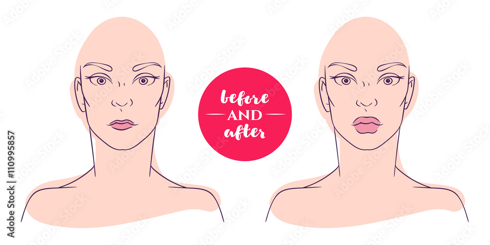 Portrait of a woman before and after with cosmetic defects. 