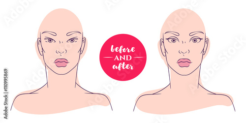 Portrait of a woman before and after with cosmetic defects. 