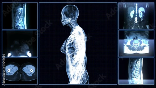 All female body systems MRI scan
