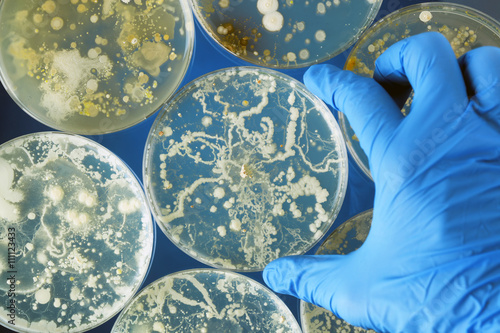 Gloved hand holding bacteria growing in a petri dishes photo