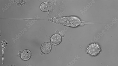 Movement of PC-3 human prostate cancer cell in culture.
