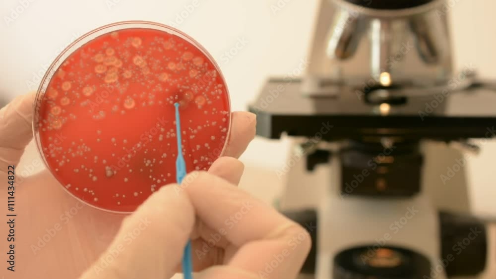 Scientist's hand checking petri dish and pointing Escherichia coli