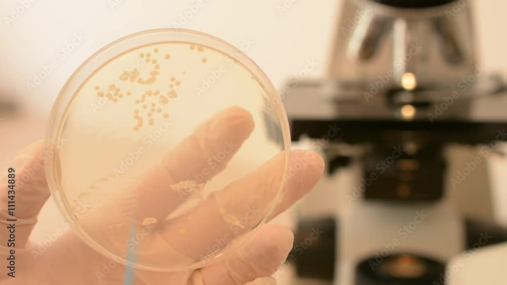 Scientist's hand checking petri dish and pointing fungus with inoculation loop. Candida albicans fungus on petri dish Scientist's hand checking petri dish and pointing fungus with inoculation loop. Candida albicans fungus on petri dish
