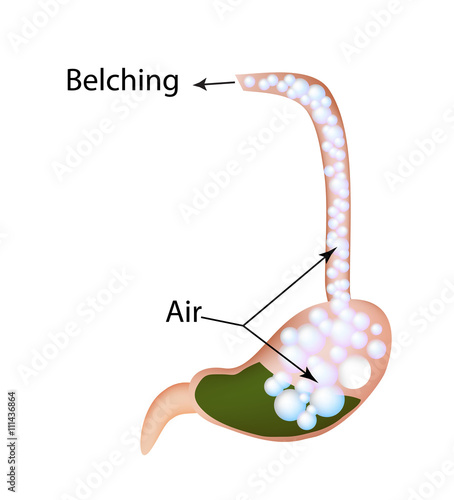 Belching. Air in the stomach. The structure of the esophagus and stomach. Infographics. Vector illustration