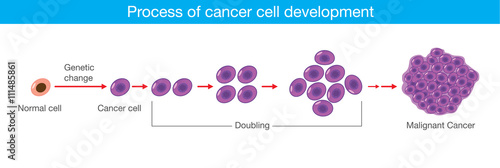 Process of cancer cell development. Medical illustration.