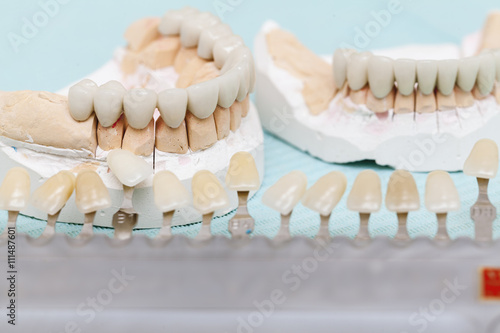 dental prostheses close up
