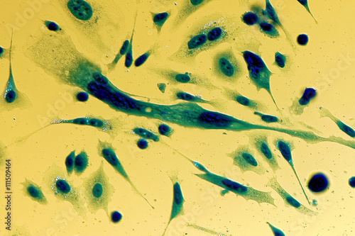 Foto PC-3 human prostate cancer cells