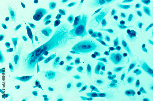 PC-3 human prostate cancer cells