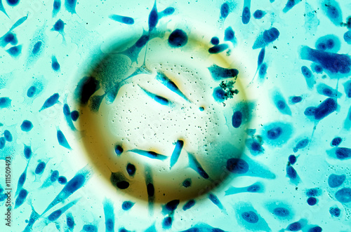Quadro su tela PC-3 human prostate cancer cells