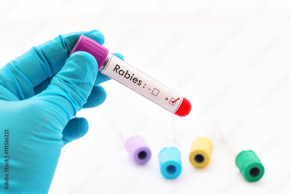 Fototapeta premium Rabies virus positive