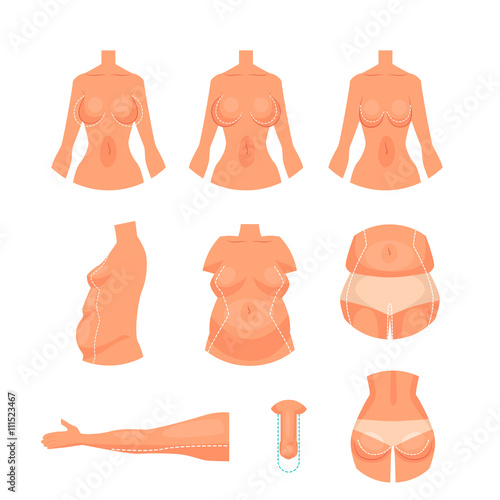 Plastic surgery of the human body, vector illustration cartoon isolated on a white background, body of people on a white background, areas of plastic surgery, breast lift belly and hands