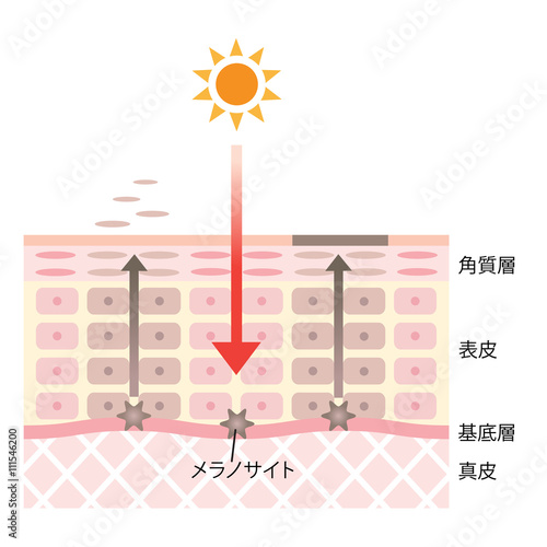 しみ　肌