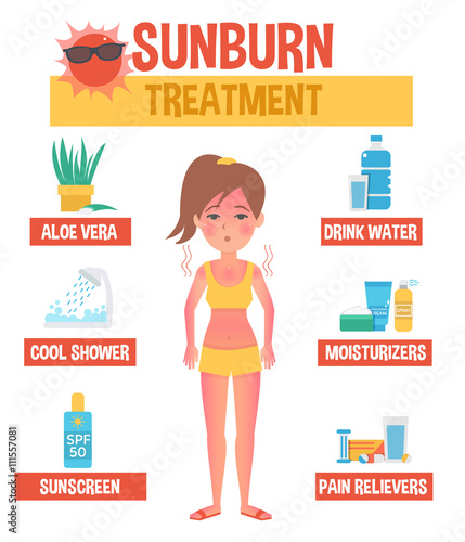 Sunburn