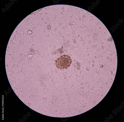 Unfertilized  Ascaris lumbricoides egg. photo