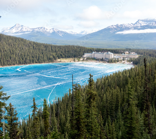Canada, Rocky Mountains: view point above lake Louise with view at the frozen lake and also the hotel Fairmont Chateau