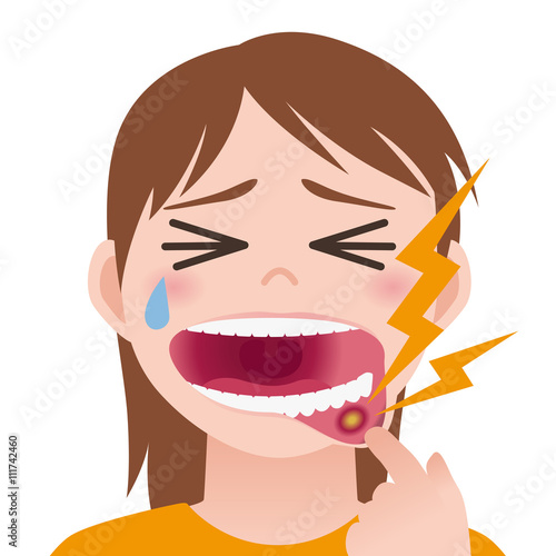 stomatitis, mouth ulcer, inflammation of the oral mucosa, image illustration