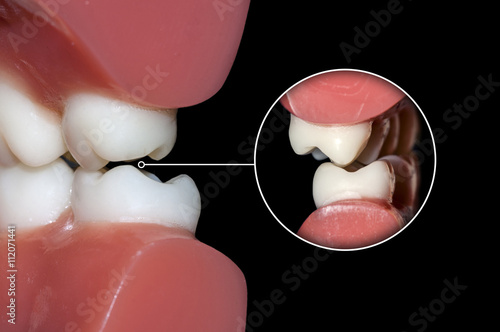 dental occlusion molars teeth close up photo