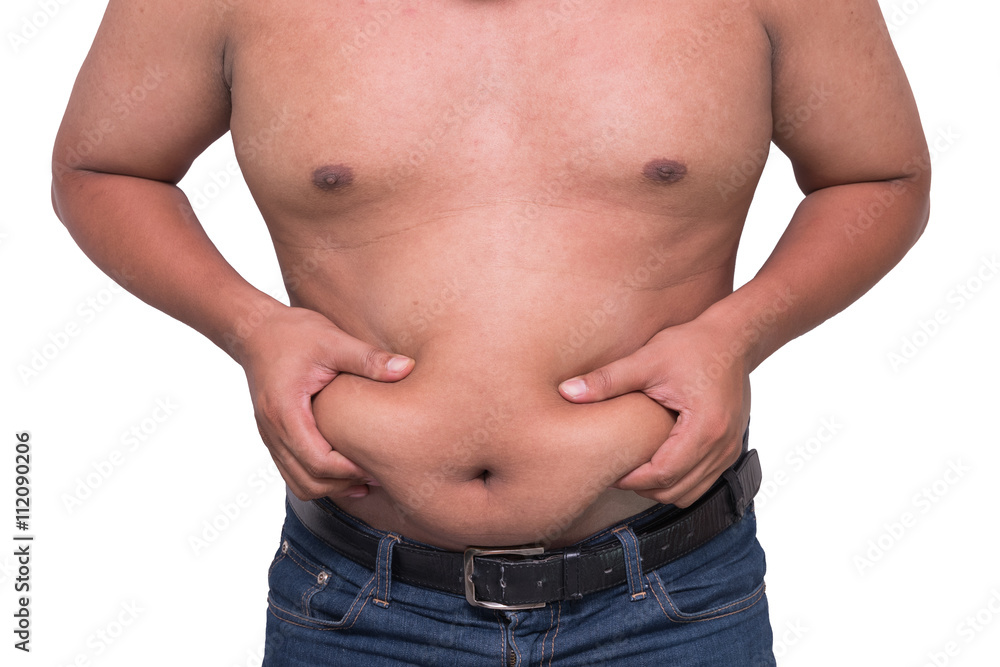 Naklejka premium man with a cellulitis on a stomach.