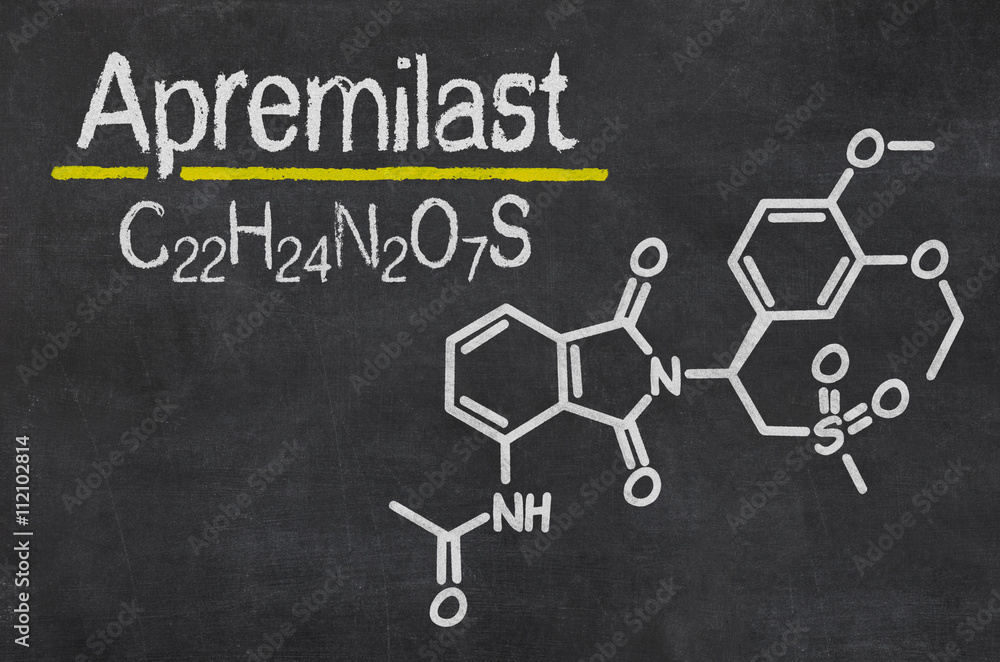 Schiefertafel mit der chemischen Formel von Apremilast Schiefertafel mit der chemischen Formel von Apremilast