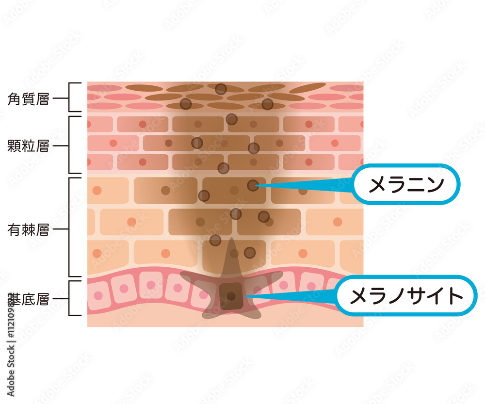 肌の仕組み シミ メラニン Stock イラスト Adobe Stock