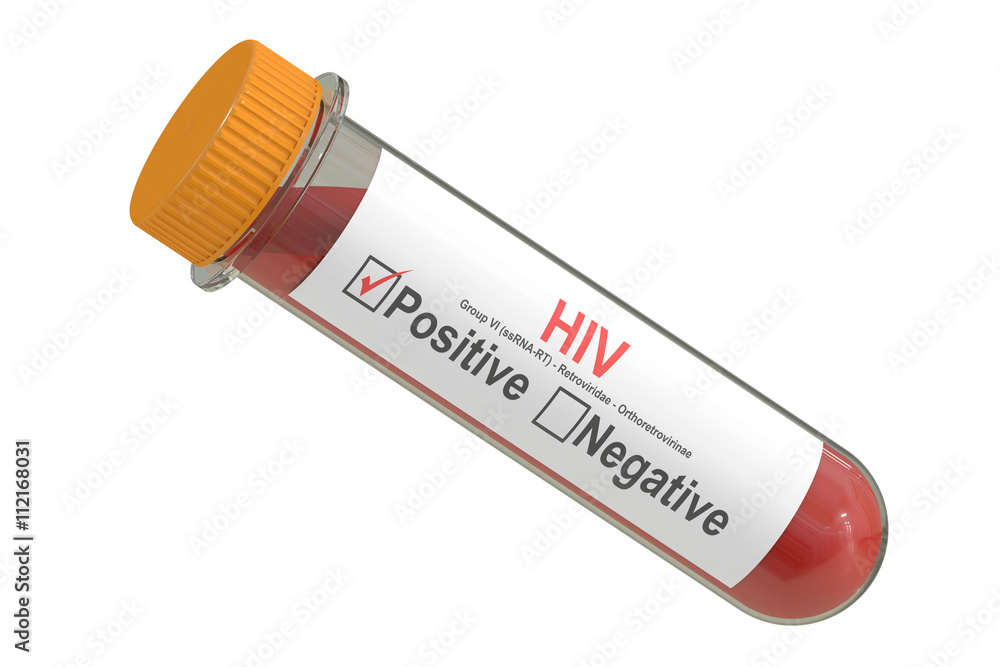 test tube with sample blood positive HIV virus. 3D rendering test tube with sample blood positive HIV virus. 3D rendering