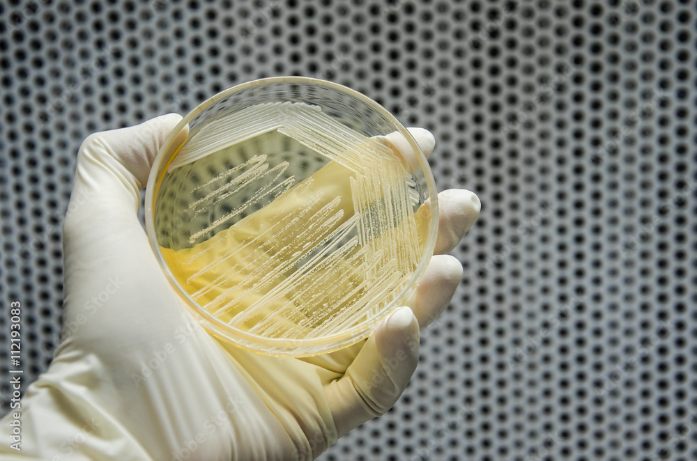 Hand in glove is holding a petri dish of cross streak of Saccharomyces cerevisiae (baker yeast