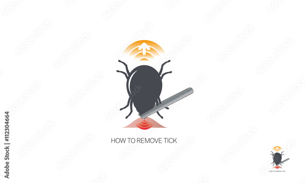 How to remove tick - dangerous insect - obrazy, fototapety, plakaty 