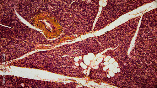 menschliche Zellen unter dem Mikroskop - Anatomie / Histologie / Pathologie photo