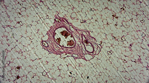 menschliche Zellen unter dem Mikroskop - Anatomie / Histologie / Pathologie photo