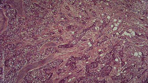 menschliche Zellen unter dem Mikroskop - Anatomie / Histologie / Pathologie photo