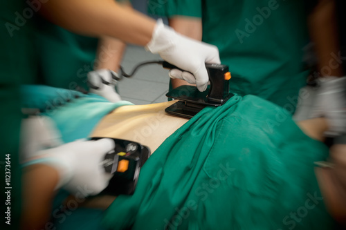Defibrillator practice on a CPR with motion blur